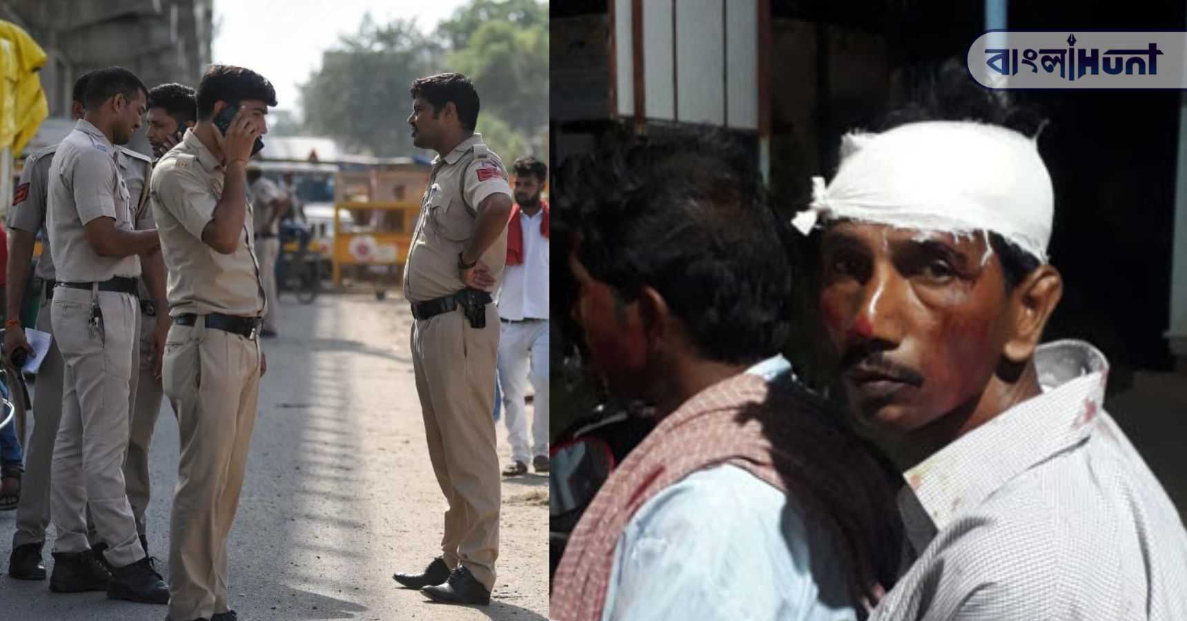 Bjp injured