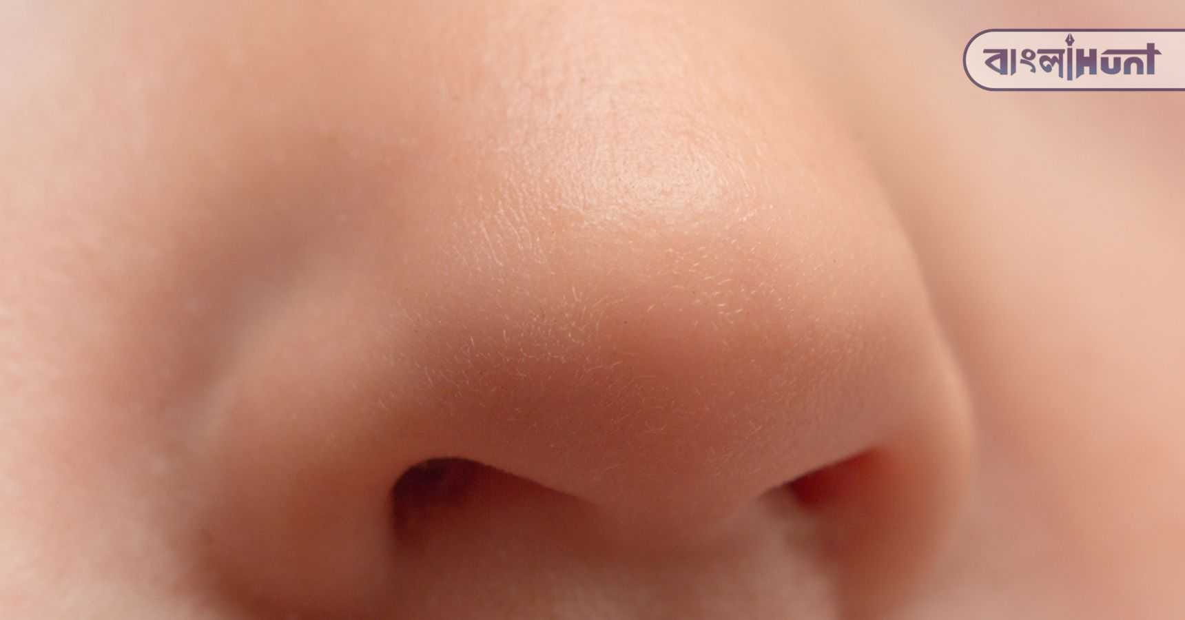 Nose
