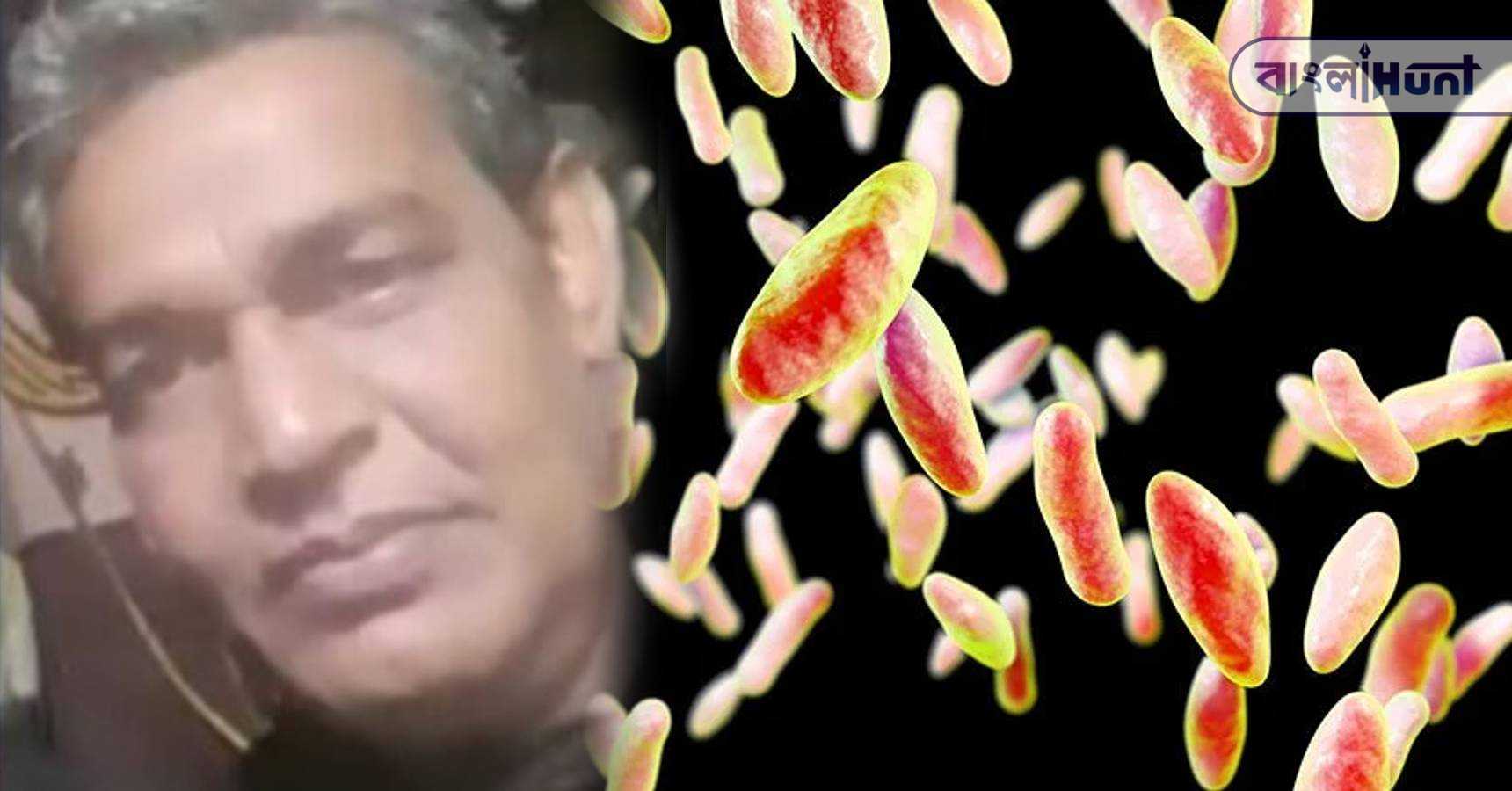 brucellosis