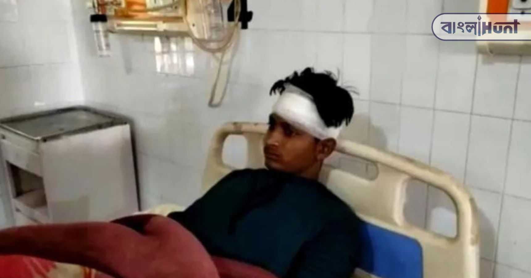 banda lover beaten