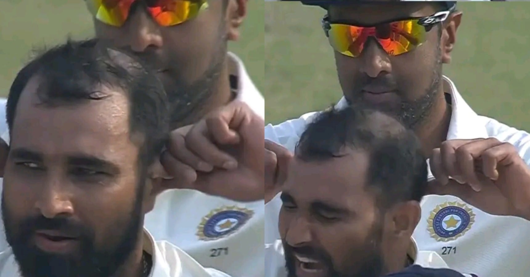 ashwin shami ear