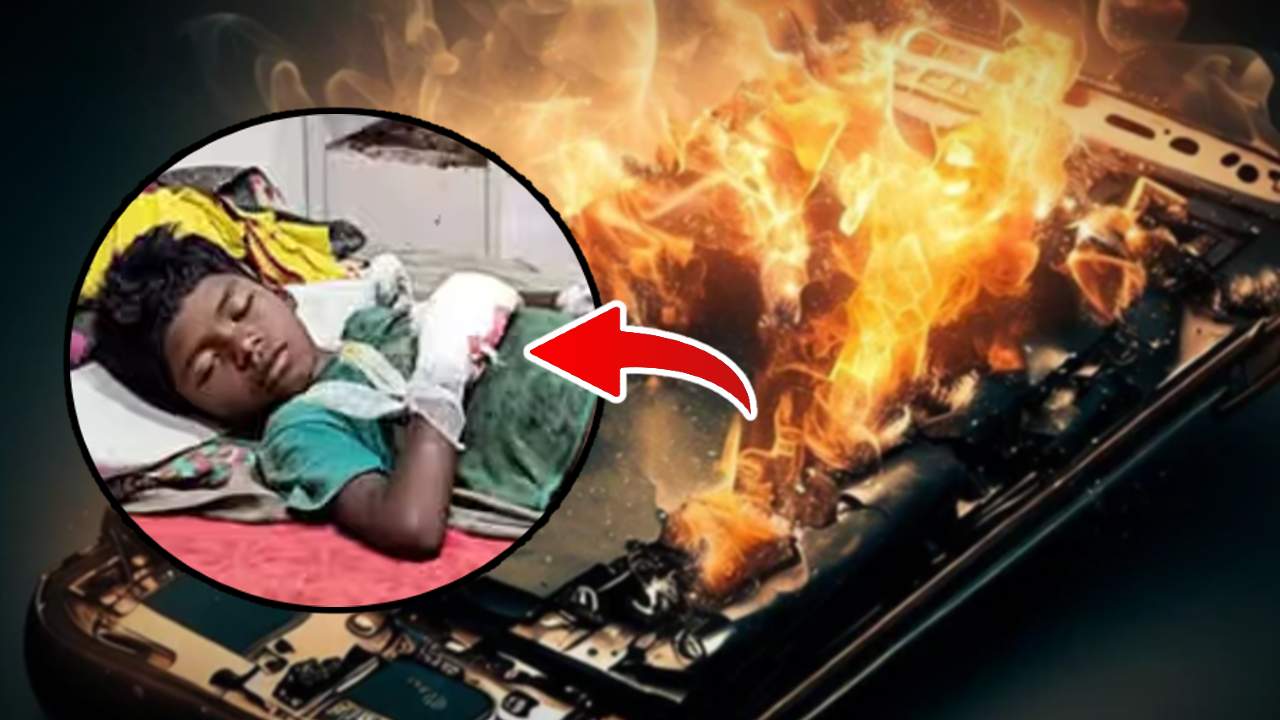 The mobile phone exploded in the hands of a 9-year-old boy.