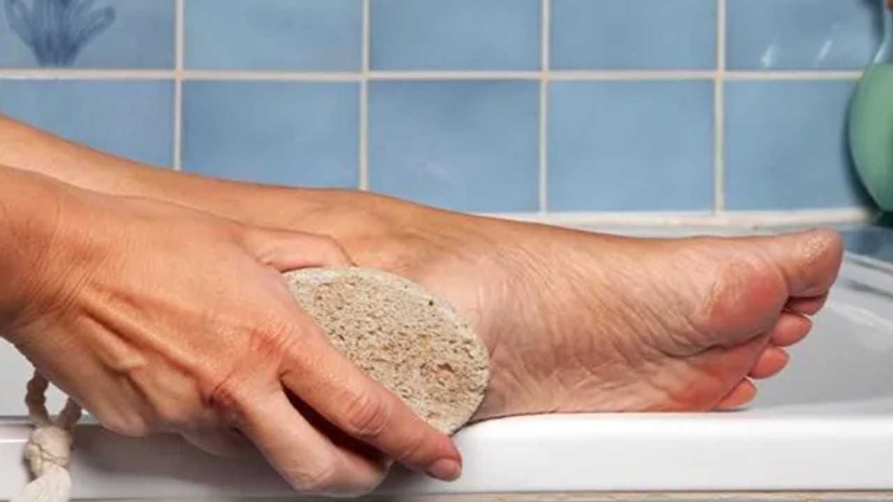 How to take care of your feet to avoid cracked heel in winter
